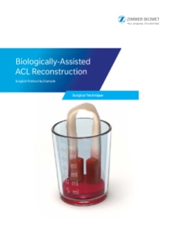 BioCUE® BBMA: Advanced Blood and Bone Marrow Aspirate